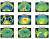 Examples of proteins having complex abundance patterns.