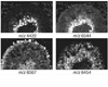 MALDI imaging MS of a 12 um thick sagittal section from a rat kidney
