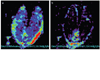 MS analysis of glucose-6-phosphate and sucrose in 15 dpa developing wheat seeds. (a) Glucose 6-phosphate, (b) sucrose