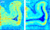 Zn and Cu distributions measured with ICP MS