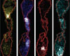 mouse epididymis