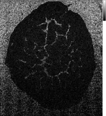 urinary bladder: m/z 157.2 ± 0.25