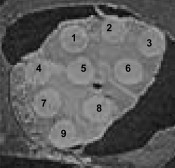 Optical image of mdr1a/1b (-/-) mouse brain section after 0.5 h post-dose of loperamide spotted by MALDI matrix for direct MALDI MS analysis