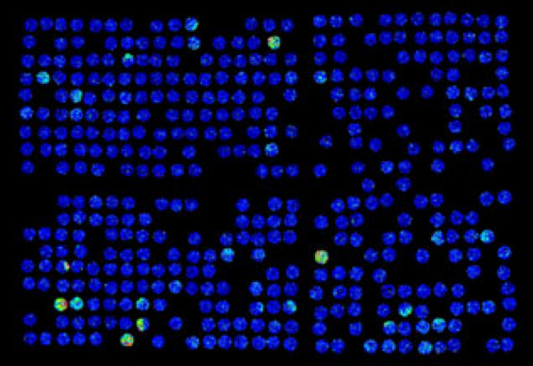 MALDI imaging mass spectrometry reveals multiple clinically relevant